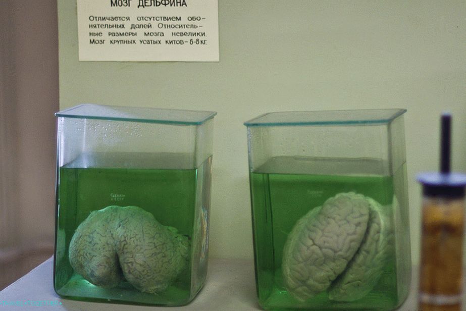 Mozak delfina i čoveka, pronađi 10 razlika